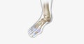 Gout is a common type of inflammatory arthritis, a disease in which the immune system attacks bones and joints