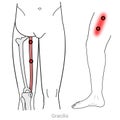 Gracilis myofascial trigger points and inner thigh pain