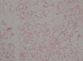 Gram negative bacilli with bipolar stain bacteria.Burkholderia pseudomallei