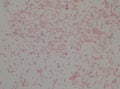 Gram negative bacilli with bipolar stain bacteria.Burkholderia pseudomallei