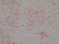 Gram negative bacilli with bipolar stain bacteria.Burkholderia pseudomallei