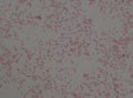 Gram negative bacilli with bipolar stain bacteria.Burkholderia pseudomallei