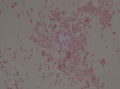 Gram negative bacilli with bipolar stain bacteria.Burkholderia pseudomallei