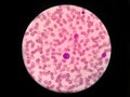 Plasmocyte on red blood cell count Royalty Free Stock Photo