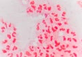 Gram negative diplococci intracellular