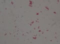 Gram negative diplococi bacteria Neisseria spp