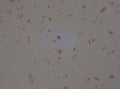 Gram negative diplococi bacteria Neisseria spp