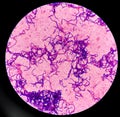 Gram positive cocci in chain