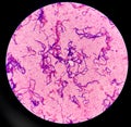 Gram positive cocci in chain