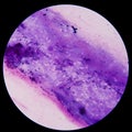 Gram positive cocci