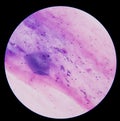 Gram positive cocci