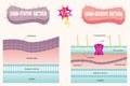 gram-positive vs gram-negative bacteria Royalty Free Stock Photo