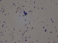 Gram stain Gram positive cocci