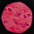 Gram stain showing blue cells gram positive in single