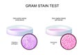 Gram stain test. glass Petri dish with culture Gram-negative and Gram-negative bacteria