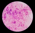 Gram stain test showing bacteria cells.