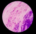 Gram stain test showing bacteria cells.