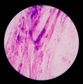 Gram stain test showing bacteria cells.