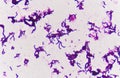 Gram staining, also called Gram`s method,. Royalty Free Stock Photo