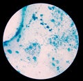 Gram staining, also called Gram's method, is a method of differe