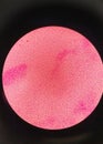 Gram staining , is a method of differentiating bacterial species. gram negative coccus