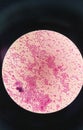 Gram staining, is a method of differentiating bacterial species into two large groups, gram positive coccus