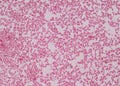 Gram staining, also called Gram`s method, is a method of differe