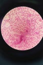 Gram staining , also called Gram's method, gram positive coccus