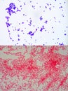 Gram staining