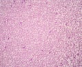 Gram staining