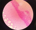 Gram staining , is a method of differentiating bacterial species. gram negative coccus