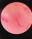 Gram staining , is a method of differentiating bacterial species. gram negative coccus