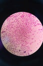 Gram staining ,gram positive coccus