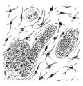 Grandular carcinoma in which the stroma has converted into mucoid tissue, vintage engraving