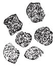 Granular degenerationcloudy swelling of liver cells, vintage engraving