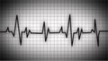 graph of heart rate. The heartbeat. A heartbeat graph. Normal heartbeat line on electrocardiogram