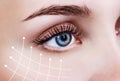 Graphic lines showing facial lifting effect on skin. Royalty Free Stock Photo