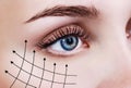 Graphic lines showing facial lifting effect on skin. Royalty Free Stock Photo