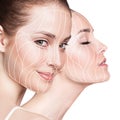 Graphic lines showing facial lifting effect on skin. Royalty Free Stock Photo