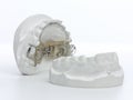 Gray Dental Prosthesis Teeth Mold, Clay Human Gums Model tooth brace