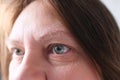 Gray eye with spots on iris, wrinkles on eyelids close up, human vision concept, optic nerve health, nervous tic, myopia,