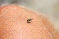 Green beetle insect on hairy skin