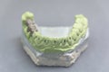 Green dental tooth implant plaster pattern with metal bridge on table