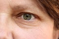 Green eye with brown spots on the face of an elderly woman, small wrinkles on the eyelids, overhang, the concept of age-related Royalty Free Stock Photo