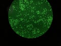 The Green fluorescence protein-expressing cell through a cofocal microscope