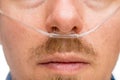 Nasal cannula closeup