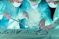 Group of surgeons in masks performing operation. Scene of operation room colored in green. Medicine, surgery and