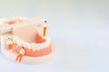 Group of teamwork miniature people, small model human figure standing and sitting on model tooth on white background, copy space Royalty Free Stock Photo