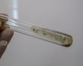 Grown colonies of gonorrhea in test tube after a positive reaction to cytochrome oxidase