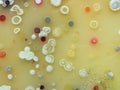 The growth of Actinobacteria cololonies on Cyganow and ÃÂ½ukov`s agar plates, with different colony texture and colors